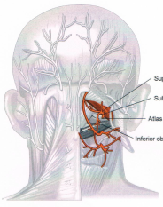 頭痛の神経図４